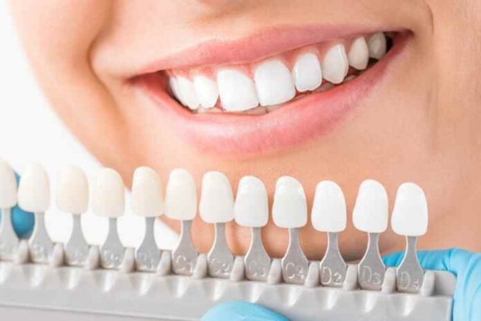 Dental Implant vs Dental Crown