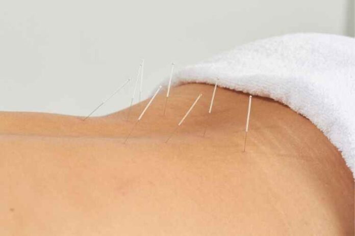 Pregnancy Acupuncture How It Works And What You Should Expect